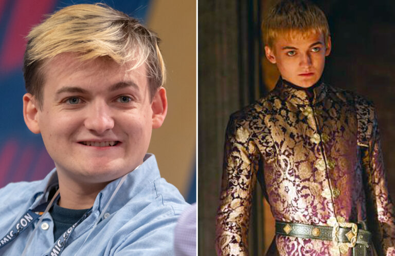 Jack Gleeson before after
