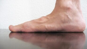 Do you regularly get aching feet? It must be one of those serious health problems… 