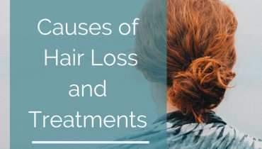 Hair Loss in Women: Everything You Ever Wanted To Know