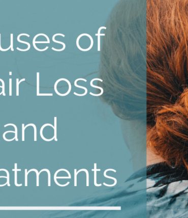 Hair Loss in Women: Everything You Ever Wanted To Know