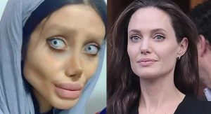 Iranian Woman’s Extreme Transformation to Resemble Angelina Jolie Sparks Online Debate
